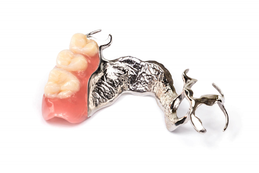 Close Up of a Metal Denture on a White Background — Cosmetic Denture Services–Jacob Maxwell in Mackay, QLD