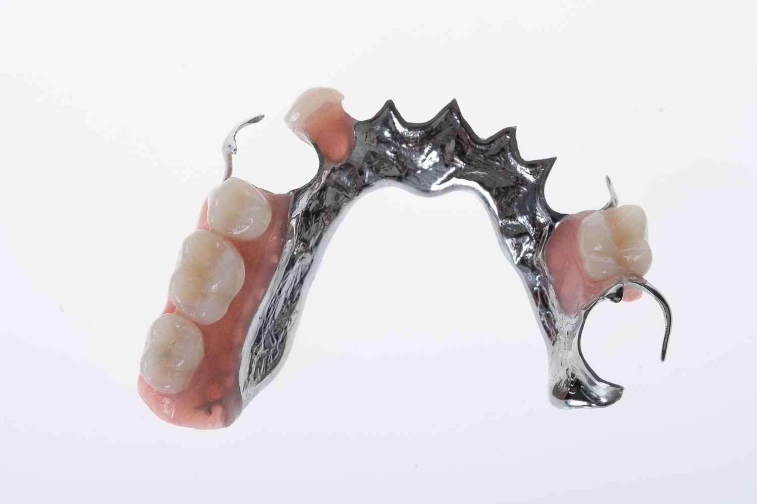 A Model of A Tooth with A Missing Tooth Next to A Pile of Teeth — Cosmetic Denture Services–Jacob Maxwell in Sarina, QLD