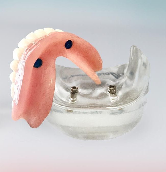 Denture is Sitting on Top of a Glass Bowl — Cosmetic Denture Services–Jacob Maxwell in Moranbah, QLD