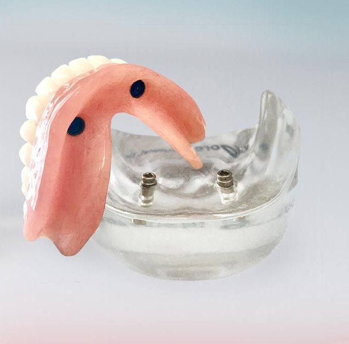 A Denture Is Sitting On Top Of A Clear Dental Model — Cosmetic Denture Services–Jacob Maxwell in Mackay, QLD