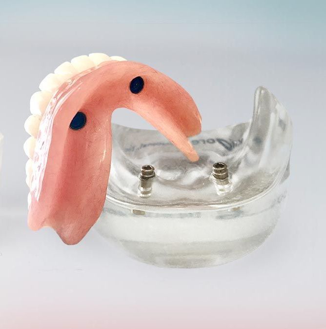 A Close up Of a Denture on A White Surface — Cosmetic Denture Services–Jacob Maxwell in Sarina, QLD