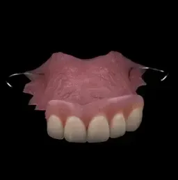 Close Up of a Denture on a Black Background — Cosmetic Denture Services–Jacob Maxwell in Proserpine, QLD