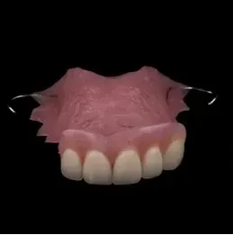 A Close up Of a Model of A Person 's Teeth on A White Surface — Cosmetic Denture Services–Jacob Maxwell in Sarina, QLD