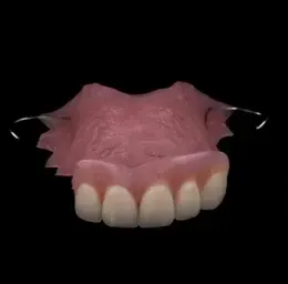 Close Up of a Denture on a Black Background — Cosmetic Denture Services–Jacob Maxwell in Moranbah, QLD