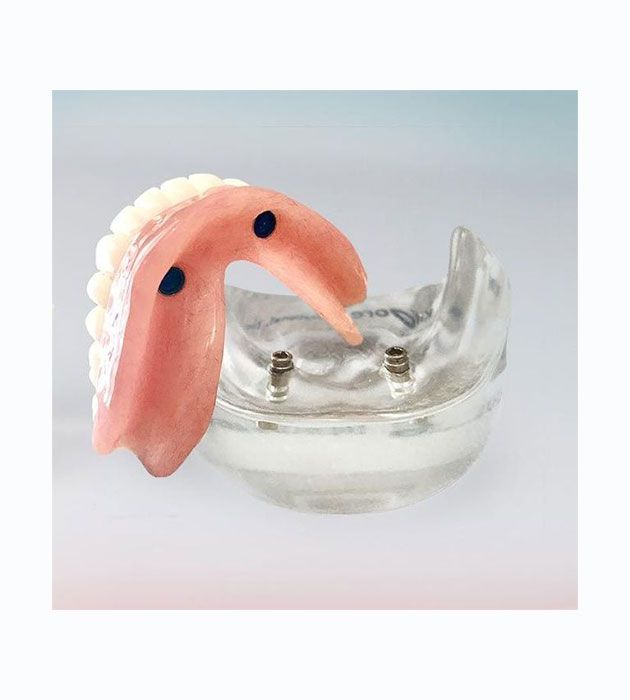 Model of a Denture is Sitting on a Glass Bowl — Cosmetic Denture Services–Jacob Maxwell in Mackay, QLD
