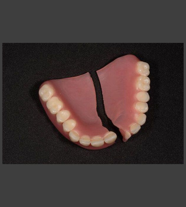 Broken Denture is Laying on a Black Surface — Cosmetic Denture Services–Jacob Maxwell in Mackay, QLD
