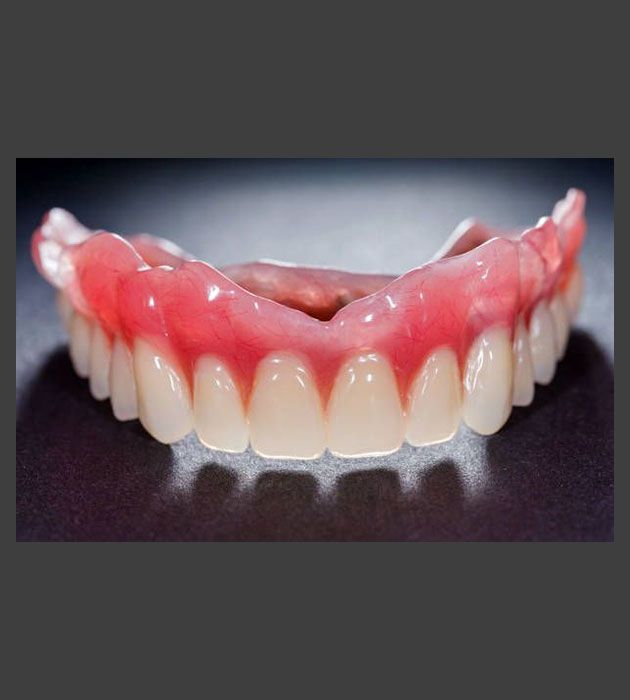 A Model Denture — Cosmetic Denture Services–Jacob Maxwell in Proserpine, QLD