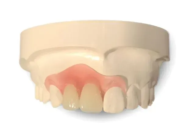 Model of a Person Teeth With a Denture on It — Cosmetic Denture Services–Jacob Maxwell in Sarina, QLD