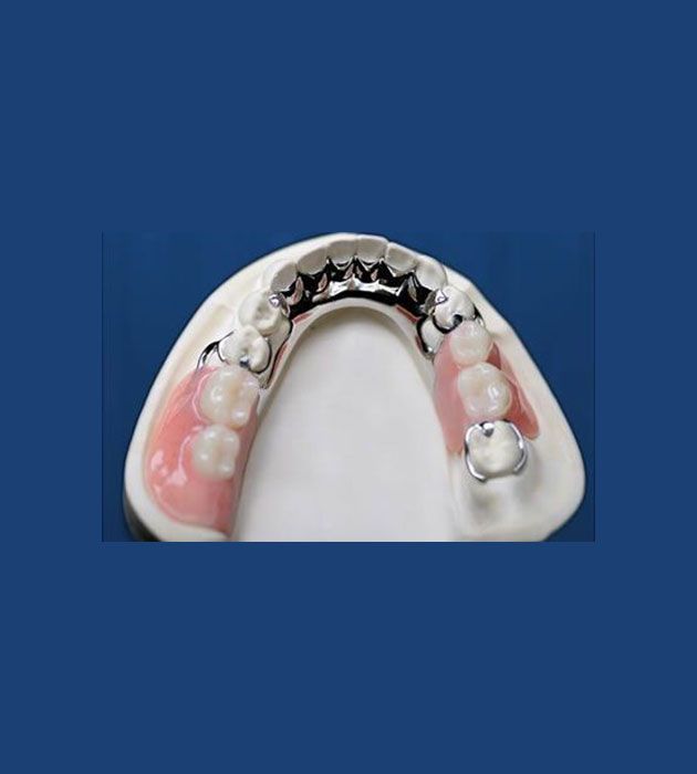 Model of a Person 's Teeth on a Blue Background — Cosmetic Denture Services–Jacob Maxwell in Mackay, QLD