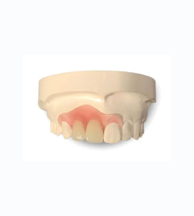 Model of a Person 's Teeth With a Prosthetic Tooth — Cosmetic Denture Services–Jacob Maxwell in Mackay, QLD