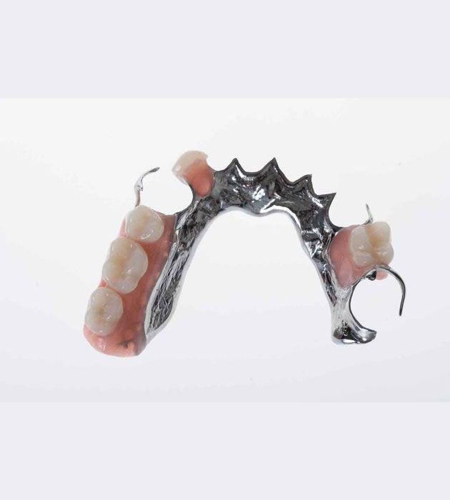 Close Up of a Partial Denture on a White Surface — Cosmetic Denture Services–Jacob Maxwell in Moranbah, QLD