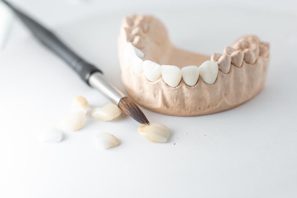 A Brush Is Sitting Next to A Model of Teeth — Cosmetic Denture Services–Jacob Maxwell in Sarina, QLD