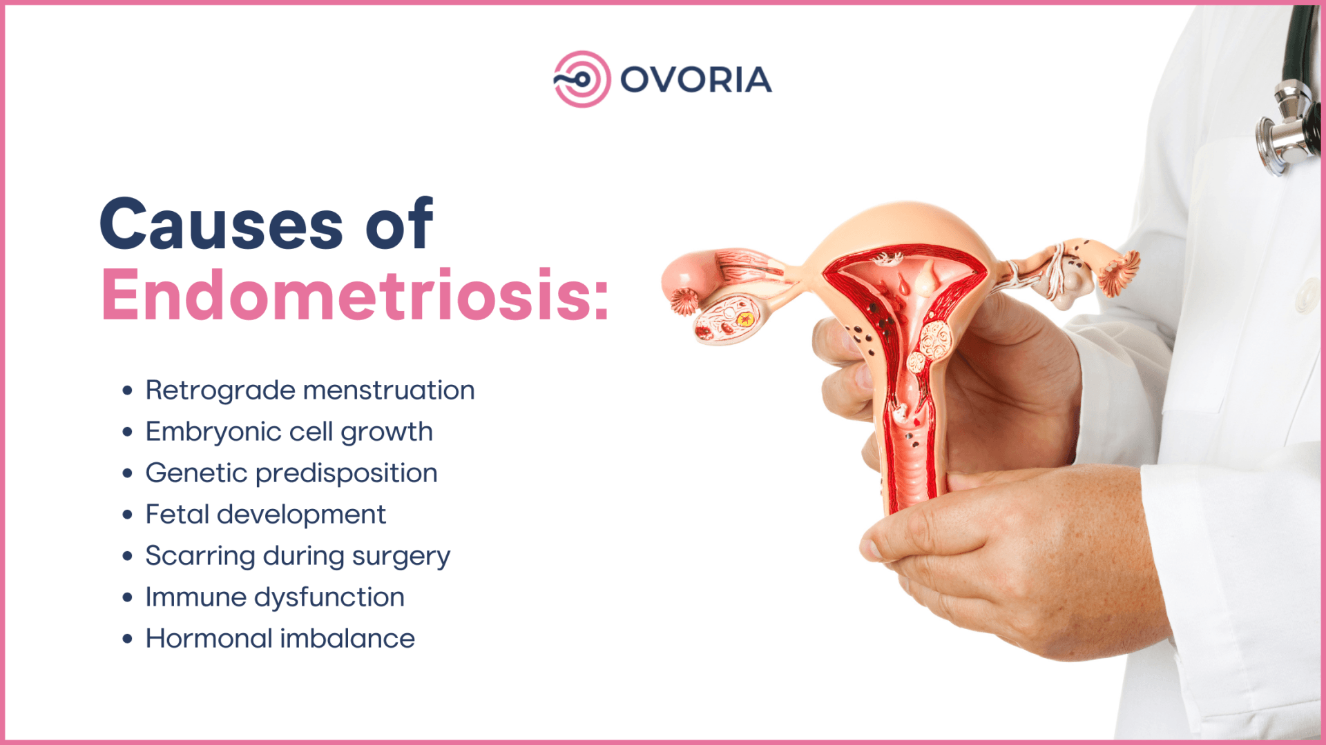 What Causes Endometriosis 