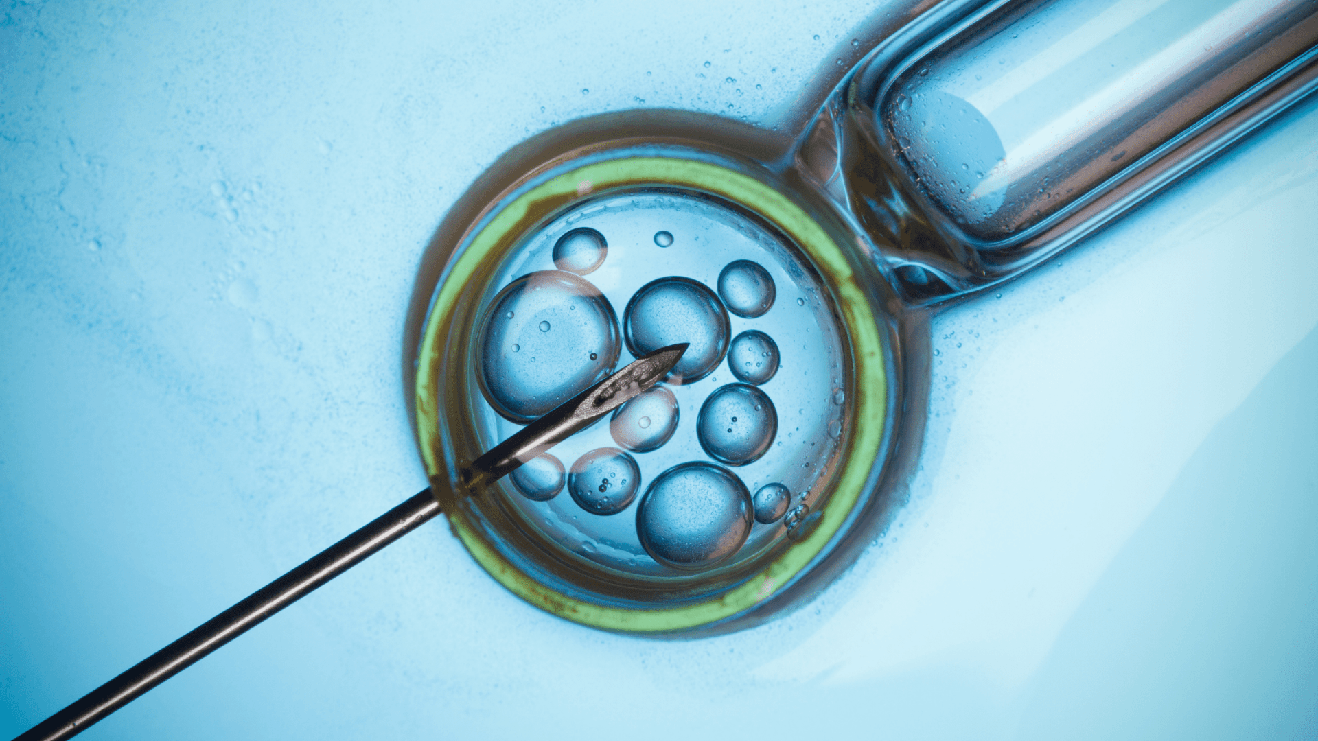 Female Infertility and IVF