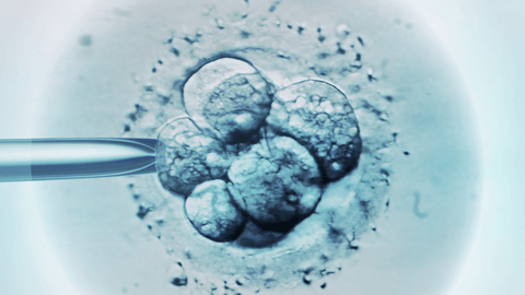 Step-by-step process of IVF