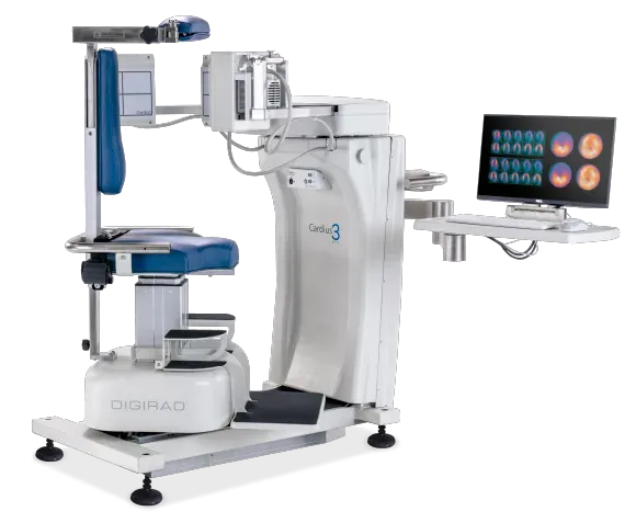Medical imaging machine, white and blue, with monitor displaying brain scans.