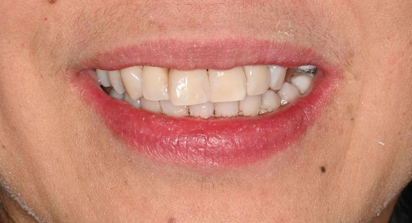 A close up of a person 's mouth with white teeth and red lips.