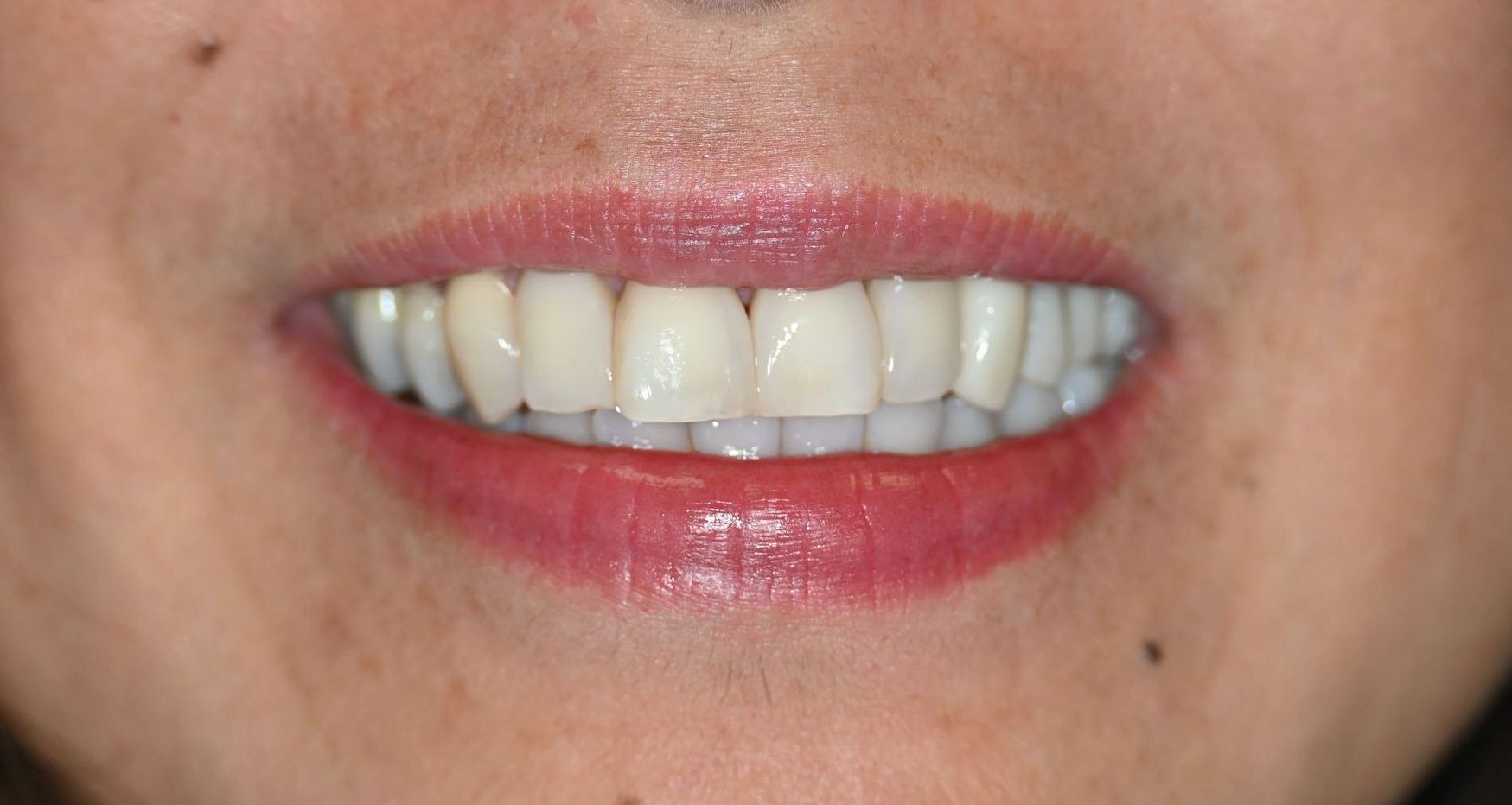 A close up of a woman 's smile with white teeth and red lips.