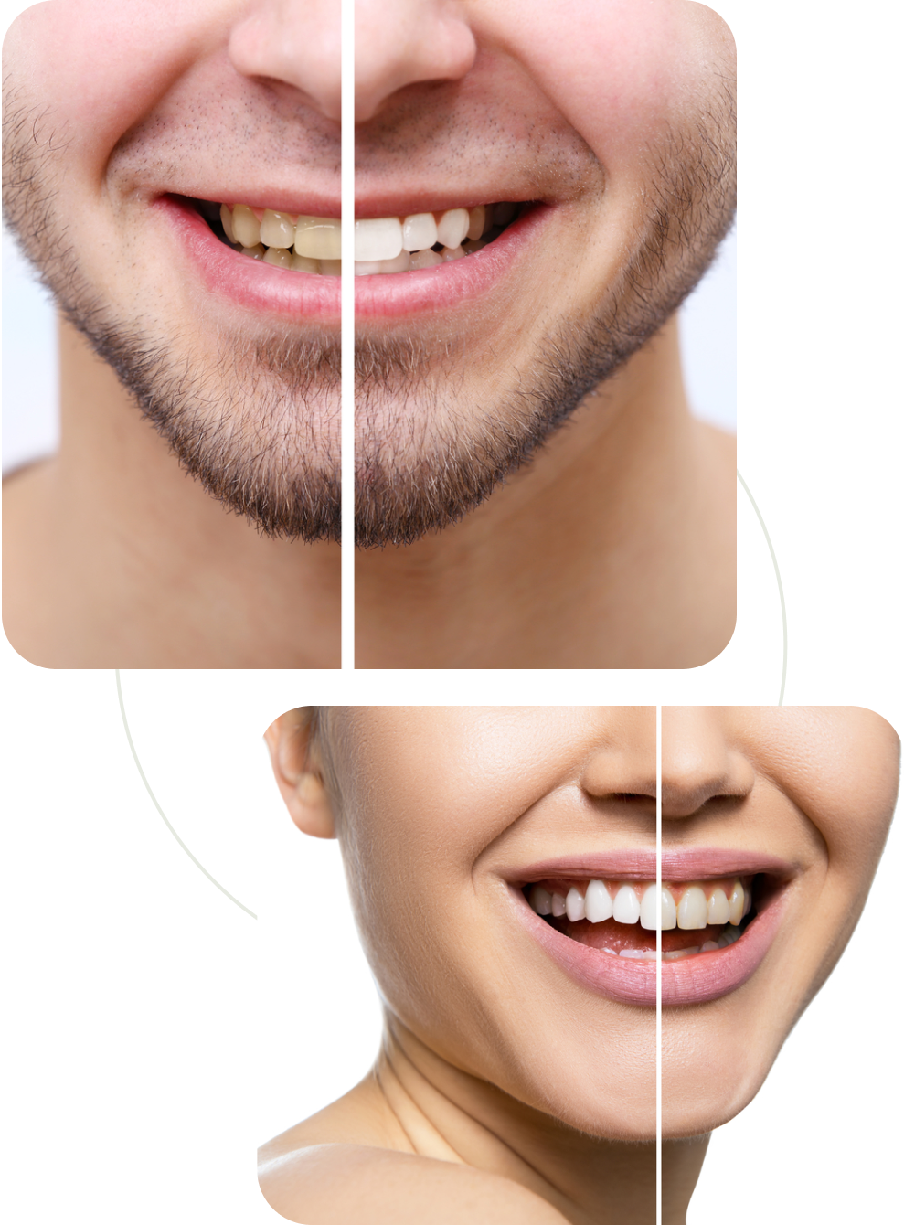 Teeth Whitening in Arroyo Grande, CA