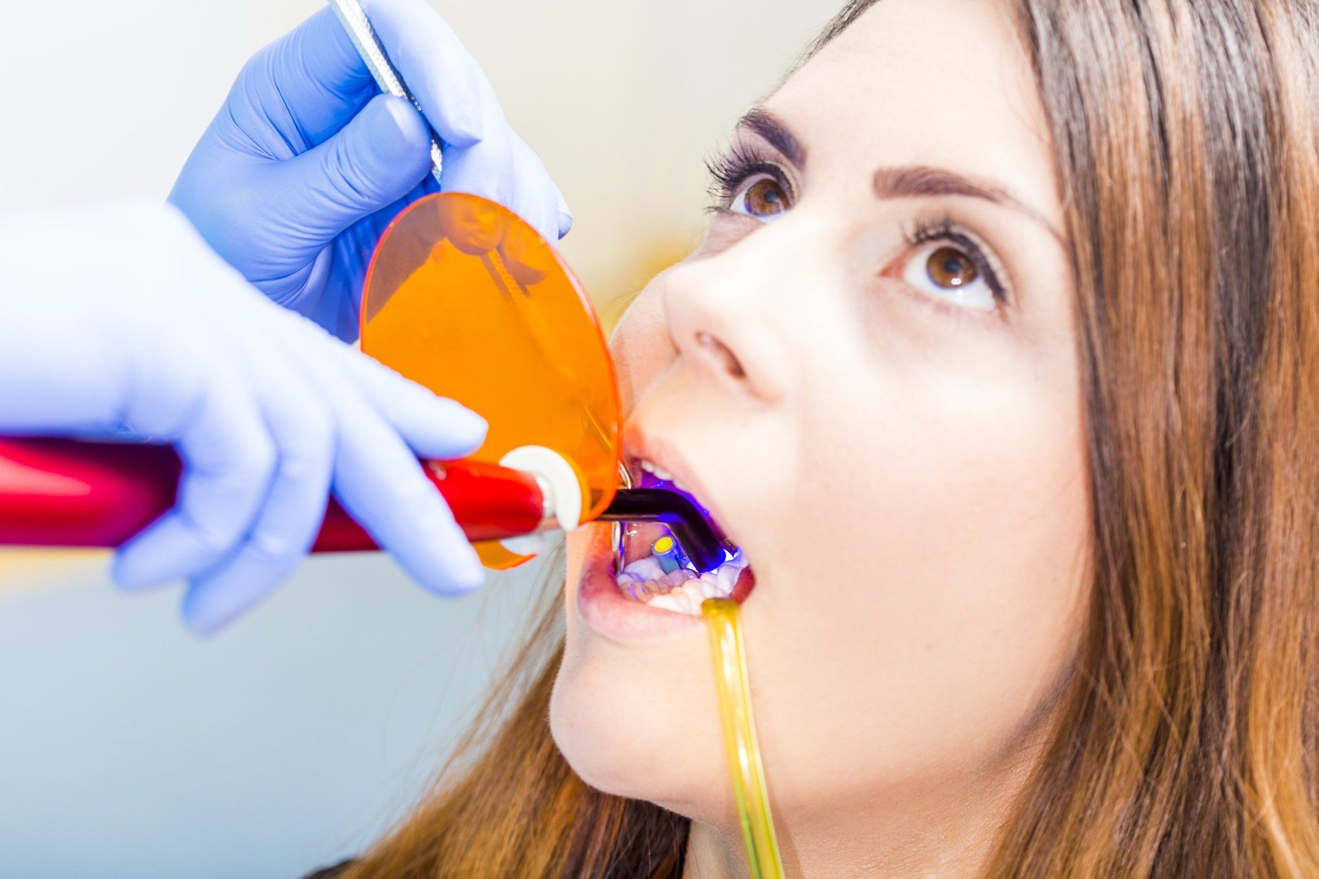 Root Canals, Dental Implants, & Teeth Whitening in Gainesville, FL