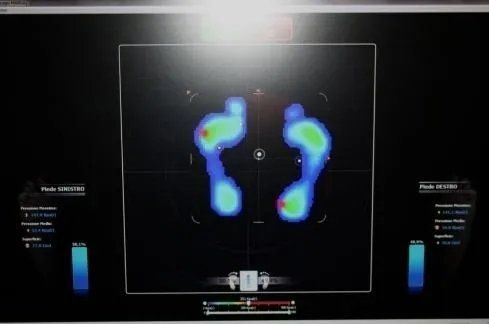 studio della postura computerizzato