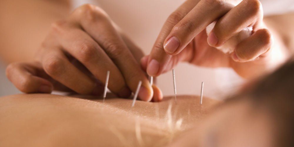 Holistic Acupuncture Treatments - Natural Health Solutions