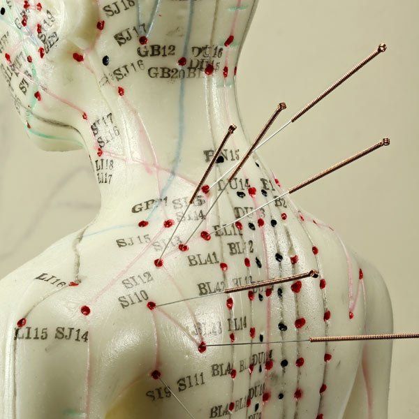 How Acupuncture Treatments Differ from Conventional Medicine