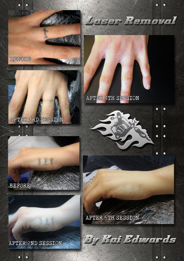 Any Tattoo-Removal-Body Piercing inquiry 🧿 📱Call:- 9558126546  🟢Whatsapp:- 9558126546 #fi… | Finger tattoos, Thumb tattoos, Finger tattoo  designs