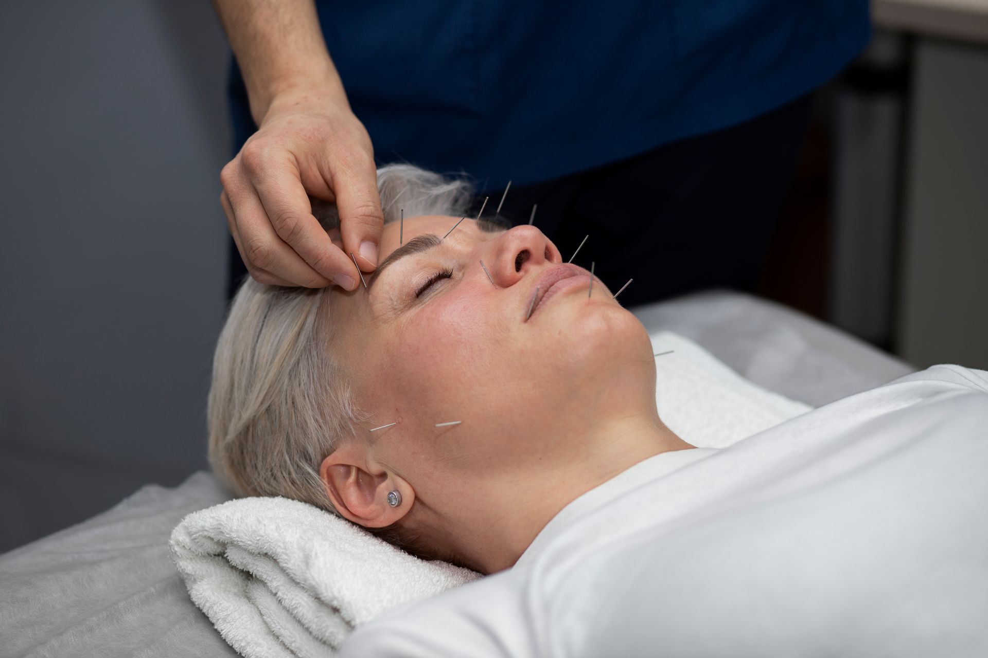 A woman is getting acupuncture on her face.