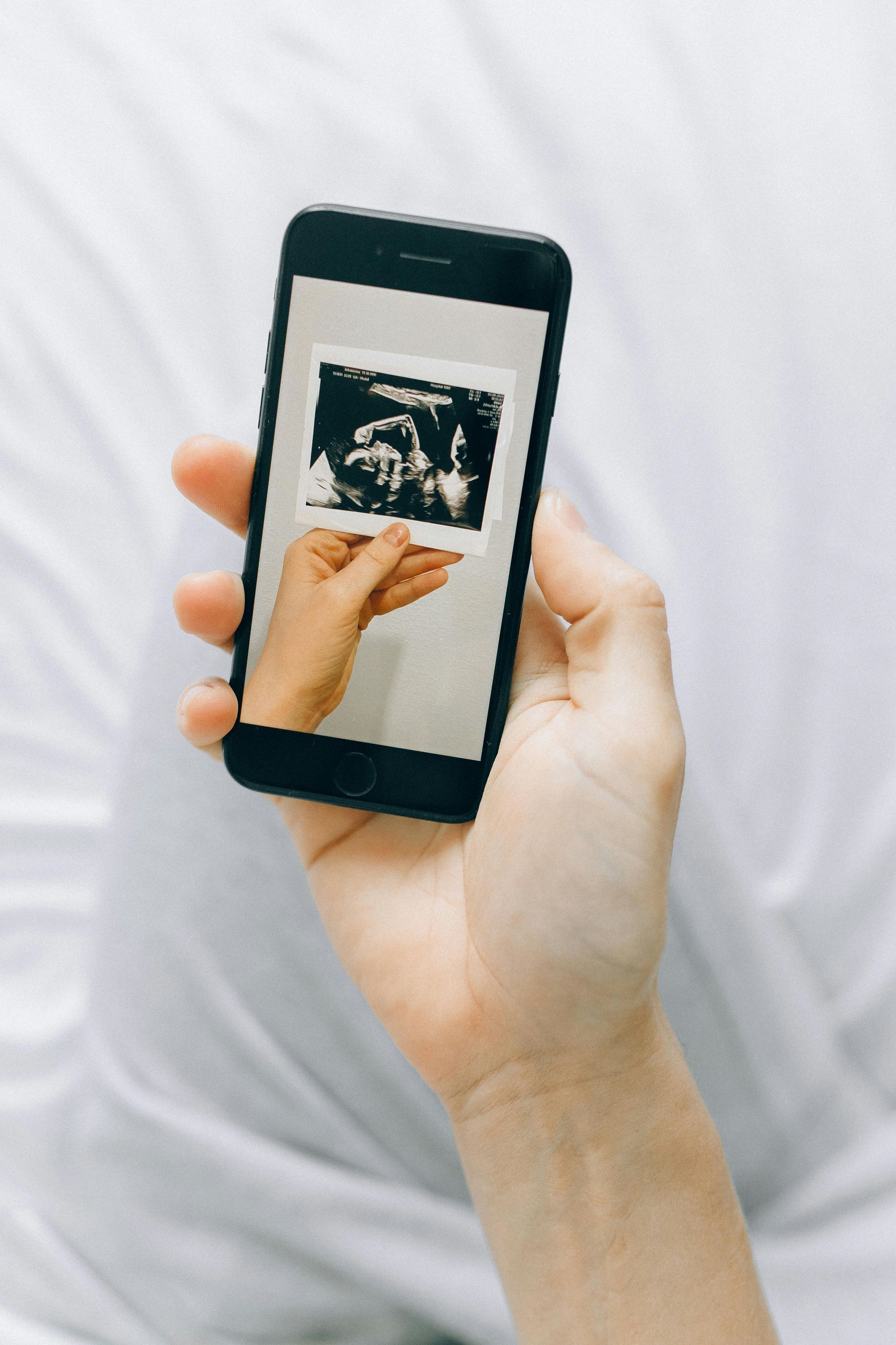 Une main tenant un smartphone affichant une image échographique, un téléphone noir sur fond blanc.