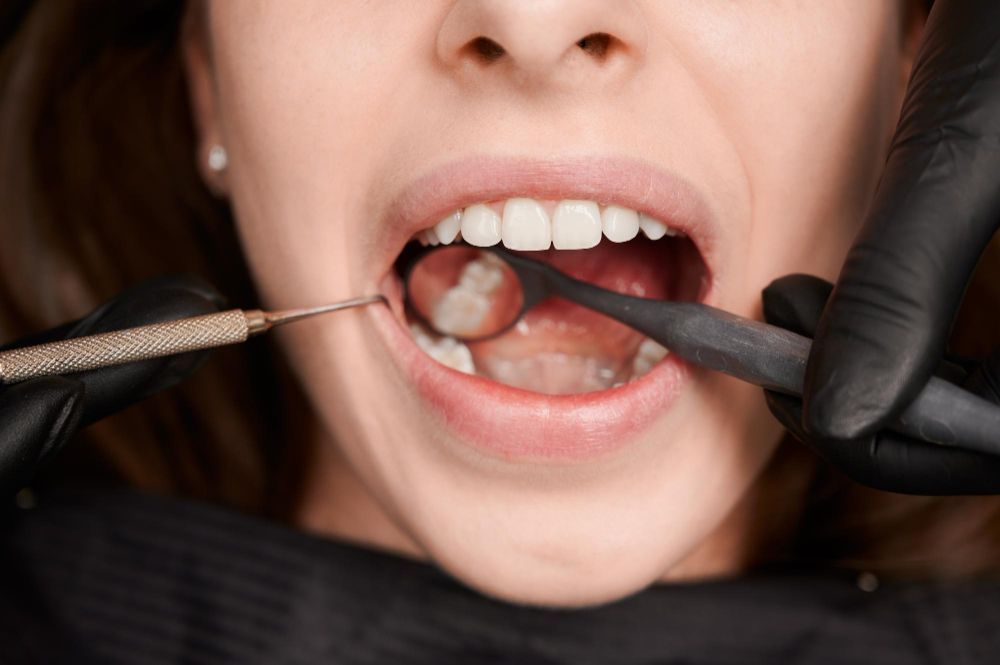 Dentist examining patient's mouth with tools. Patient with open mouth. Dentist wears black gloves.