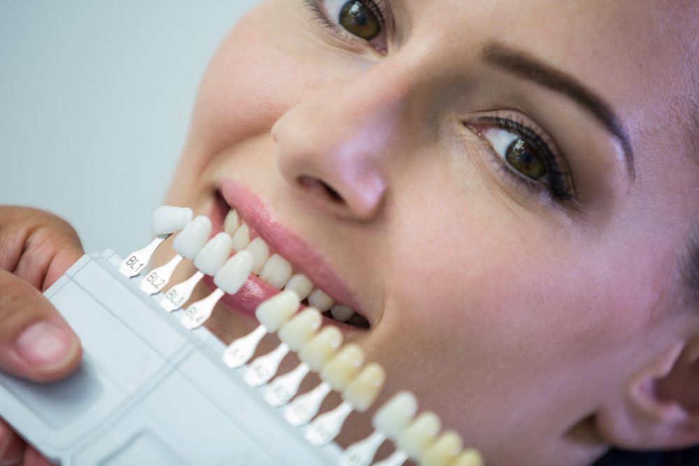 Woman at dentist choosing teeth shade using a color chart.
