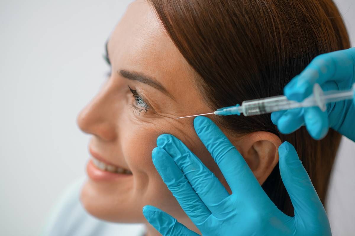 A woman receiving neurotoxin injections on crow’s feet near Lexington, Kentucky (KY)