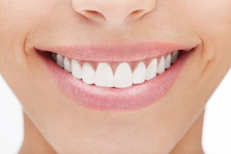 Zoom Whitening — Beautiful Smile with Clean Teeth in Tampa, FL