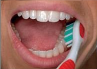 Step 1 of brushing your teeth — Dentist in Tampa, FL
