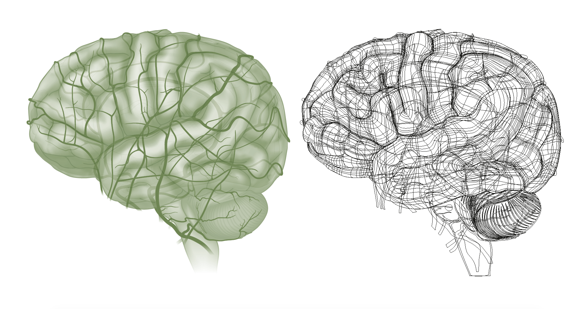 complex vector illustration brain circulation