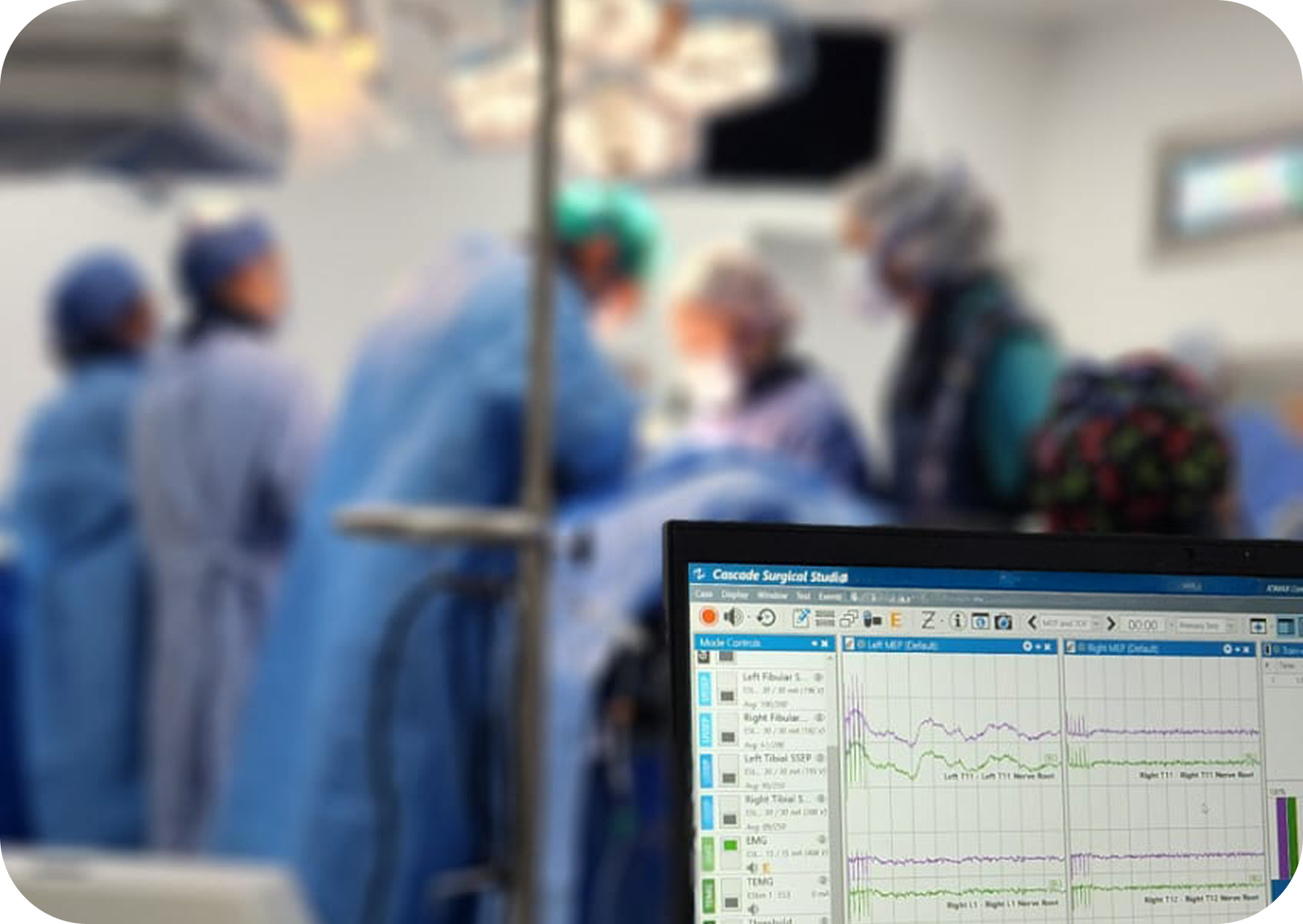 Quirófano con equipo médico, monitor muestra datos.