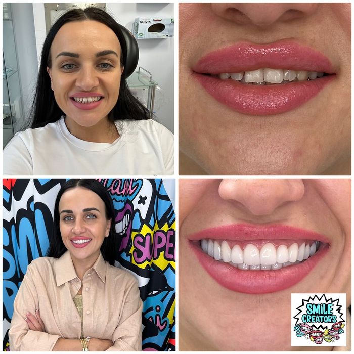 A close up of a woman 's face with a big smile