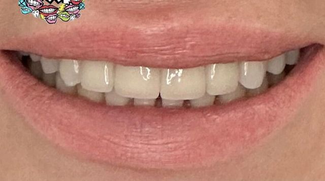 Smile Transformations | Smile Creators | Bay Harbor Islands, FL