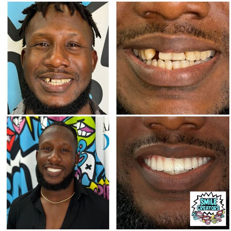 A man with a beard and missing teeth is smiling