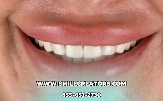 smile ZX-27 – 718-494-2200
