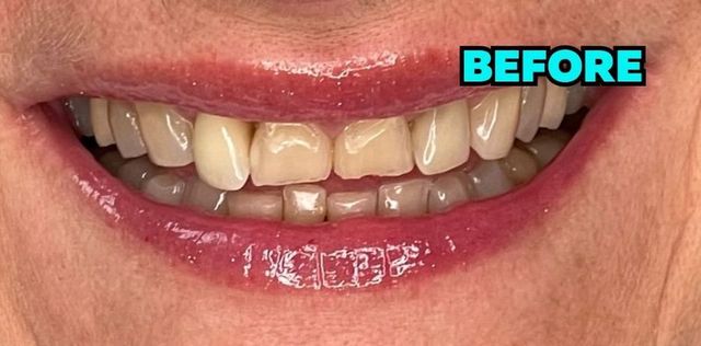 Smile Transformations | Smile Creators | Bay Harbor Islands, FL