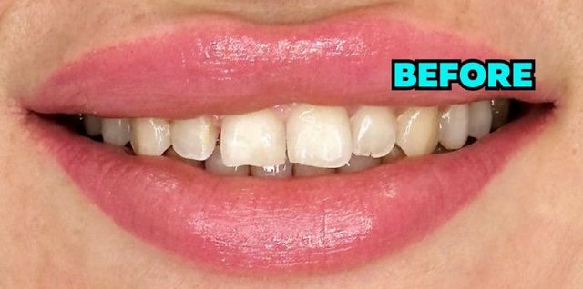 Smile Transformations | Smile Creators | Bay Harbor Islands, FL