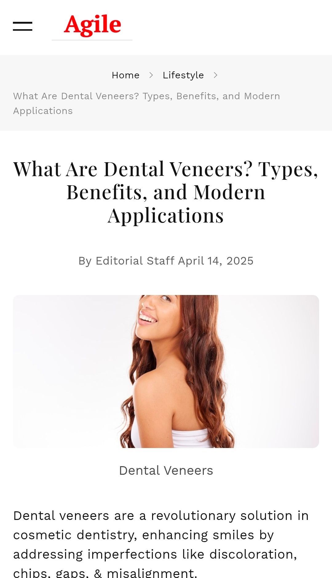 Article about dental veneers with a smiling person as an illustration.