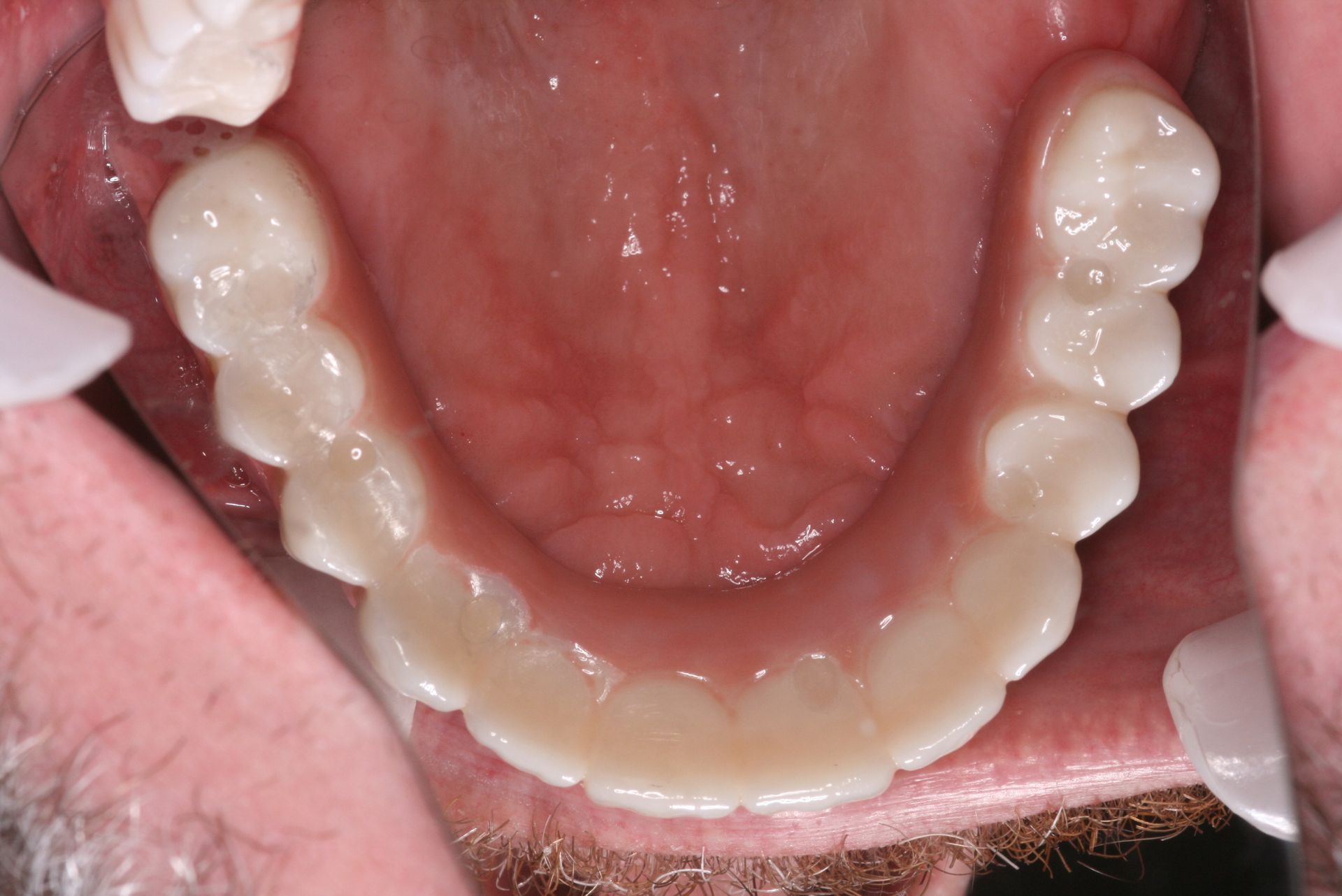 Close-up view of teeth and gums, light yellow teeth, pink gums.