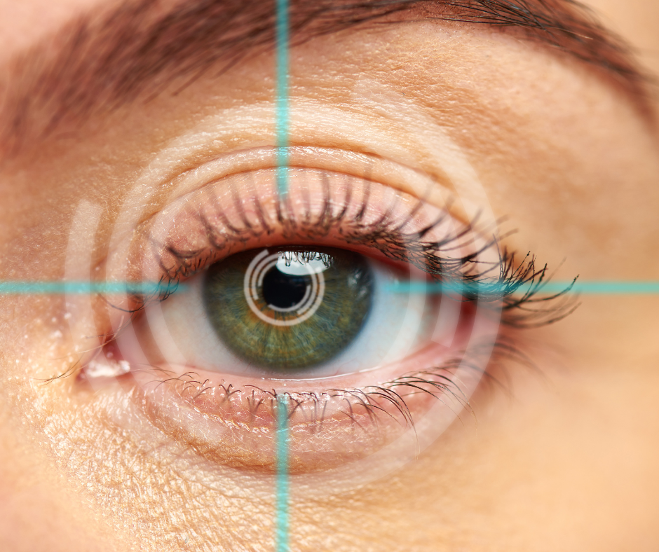 Lipiview and Lipiflow