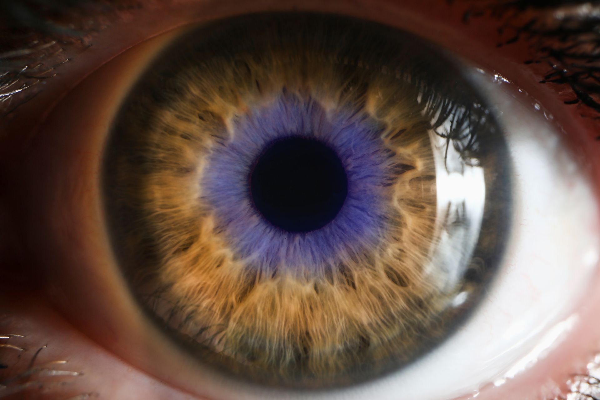 Close-up of an eye with a brown iris, blue ring around the pupil.