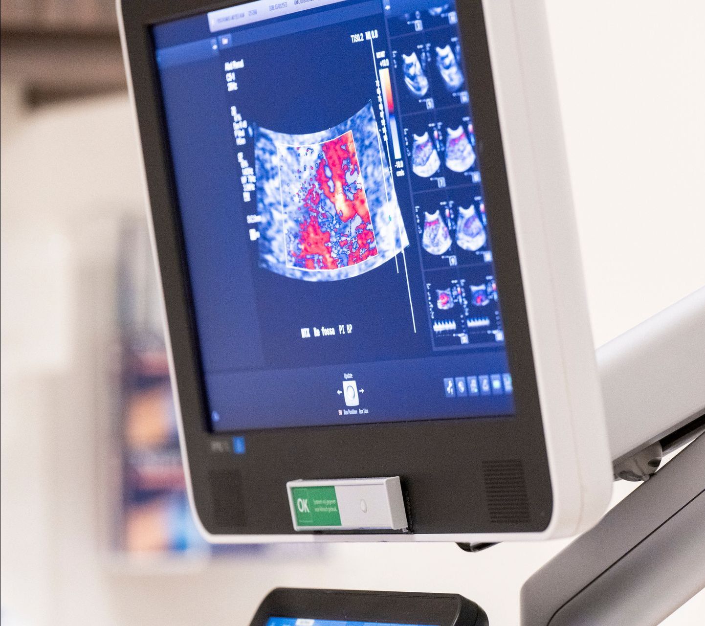 centro specializzato in senologia digitale a Bari