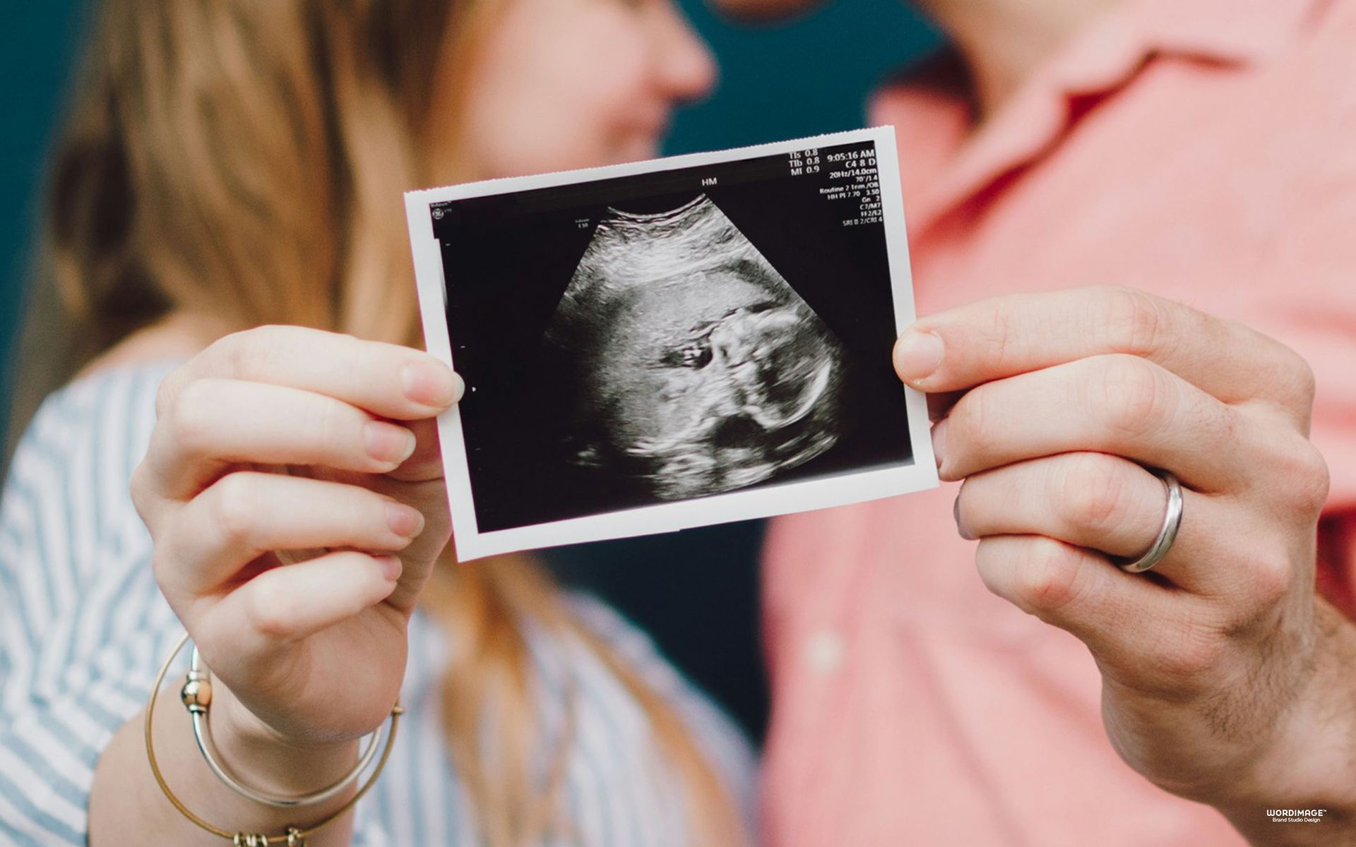 A man and a woman are holding an ultrasound of their baby.
