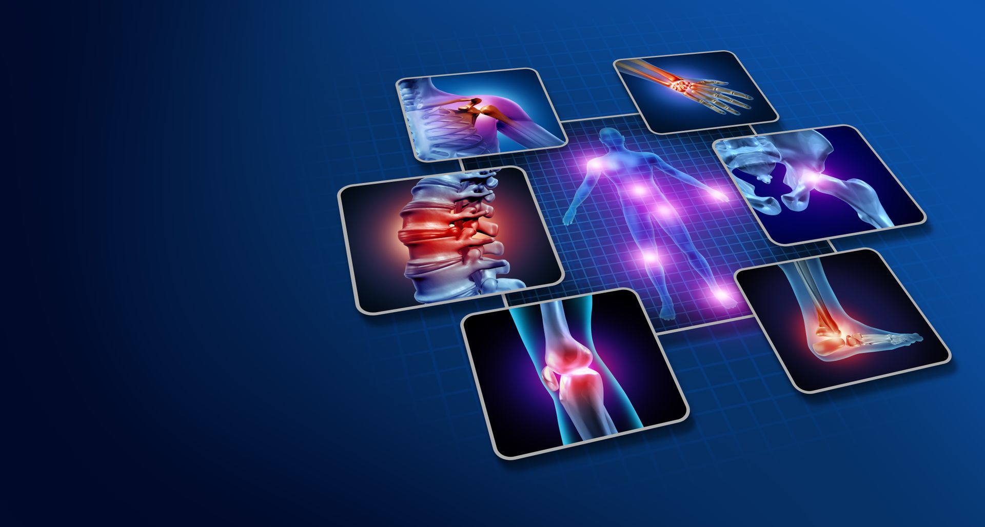 Diagram of a human body with glowing joints, surrounded by images of injured knees, back, foot, and shoulder.